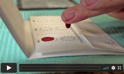 dried-blood-spot-sample-collection-instructions